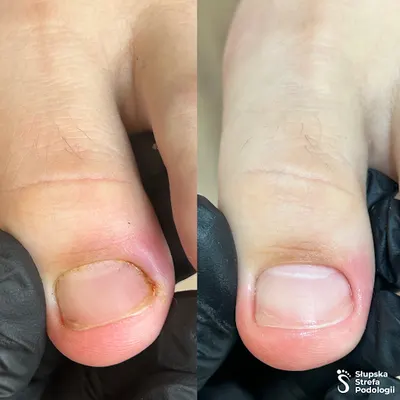 Słupska Strefa Podologii | Podolog Monika Kruczyńska